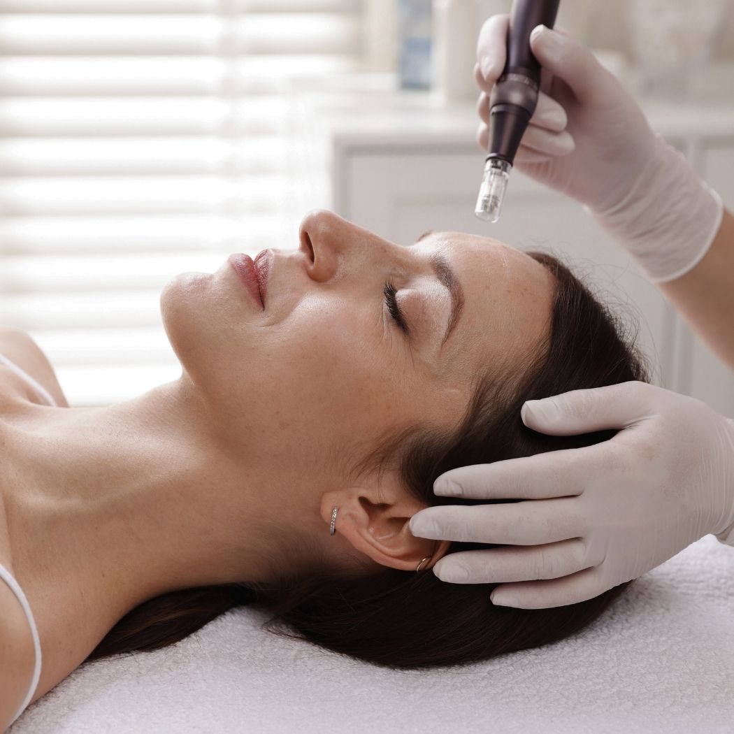 Microneedling Secret Elements Berlin